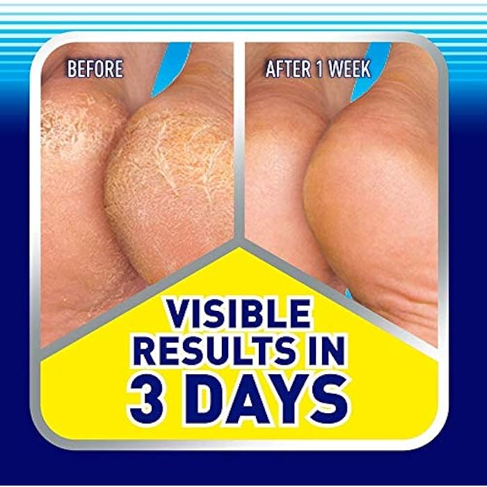Scholl Cracked Heel Repair Cream Active Repair K+ Visible Results In 3 Days 60ml - Image 3